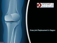 Knee Joint Replacement in Nagpur