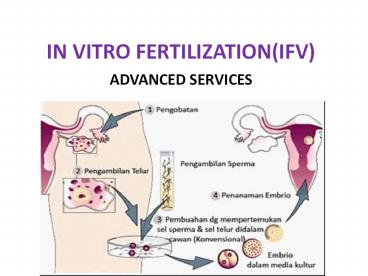 INVITRO FERTILIZATION(IFV)
