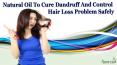Natural Oil To Cure Dandruff And Control Hair Loss Problem Safely PowerPoint PPT Presentation