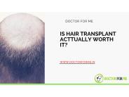 Is Hair Transplant Actually Worth it ?