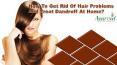 How To Get Rid Of Hair Problems And Treat Dandruff At Home? PowerPoint PPT Presentation