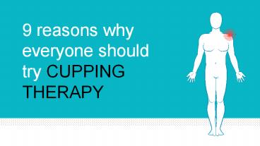 9 reasons why everyone should try cupping therapy