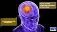 Brain Cancer-Symptoms,Diagnosis & Treatment PowerPoint PPT Presentation