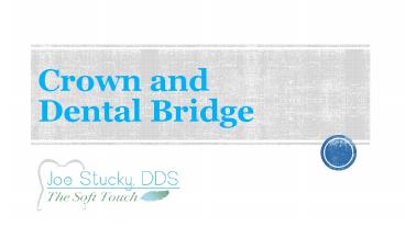 Crown and Dental Bridge