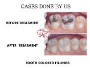 URJA MULTISPECIALITY DENTAL CLINIC (8)