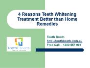 4 Reasons Teeth Whitening Treatment Better than Home Remedies