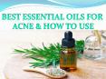 Best essential oils for acne & how to use PowerPoint PPT Presentation