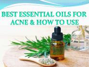 Best essential oils for acne & how to use