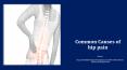 Common Causes of hip pain PowerPoint PPT Presentation