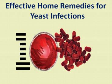 Effective Home Remedies for Yeast Infections