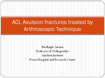 Arthroscopic ACL Acvulsion fixation