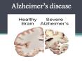 Alzheimer's disease : Overview, Symptoms, Risk Factor, Causes, Treatment and diagnosis (1) PowerPoint PPT Presentation