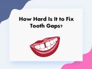 How Hard Is It to Fix Tooth Gaps?