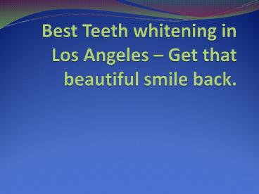 how much does a crown cost