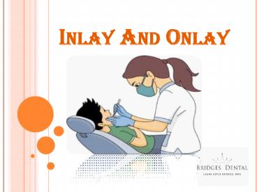 Brandon Dentist :Dental Inlay And Onlay Restoration in Bridges Dental