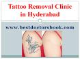 Tattoo Removal Clinic in Hyderabad | Tattoo Removal Hyderabad PowerPoint PPT Presentation