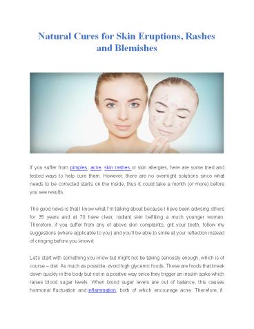 Natural Cures for Skin Eruptions, Rashes and Blemishes