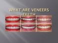 what are veneers teeth PowerPoint PPT Presentation