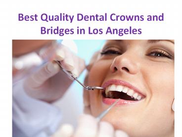 Dental crowns and bridges treatment