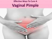 super effective ways to cure a vaginal pimple