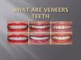 how much do porcelain veneers cost 1 july 17 PowerPoint PPT Presentation