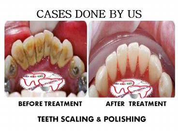 urja multispeciality dental clinic (15)