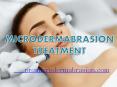 Best MicroDermabrasion Machine and Kits PowerPoint PPT Presentation
