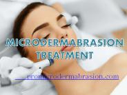 Best MicroDermabrasion Machine and Kits