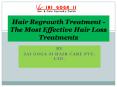 Ayurvedic Medicine for Best hair loss treatment