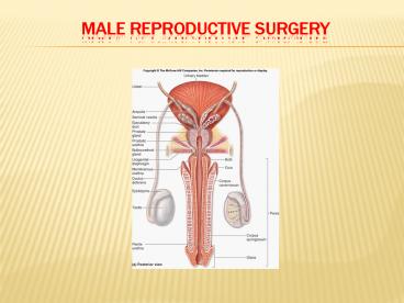 male reproductive surgery 5july17