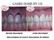 URJA MULTISPECIALITY DENTAL CLINIC (16)