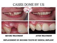 URJA MULTISPECIALITY DENTAL CLINIC (18)