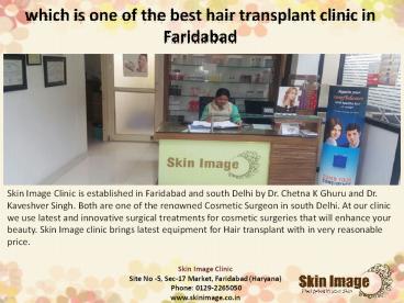 Which one is the best hair transplant clinic in Faridabad?