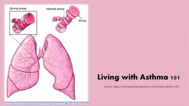 Living with Asthma 101