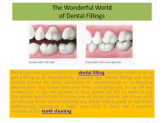 The Wonderful World of Dental Fillings