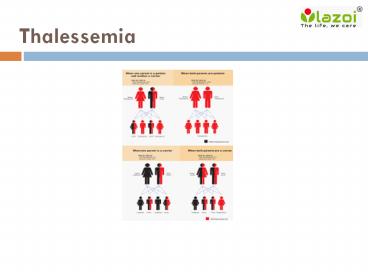 Thalessemia : Overview, Symptoms, complications, Risk factor, Causes, Daignosis and Treatment