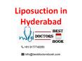 Liposuction Surgery in Hyderabad | Liposuction Surgeon Hyderabad PowerPoint PPT Presentation