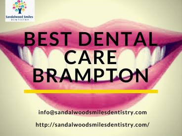 Best Dental Clinic Brampton - Sandalwood Smiles Dentistry