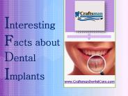 Interesting Facts about Dental Implants - Sacramento