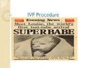 ivf for infertility 14 july 17