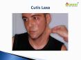 Cutis Laxa: Causes, Symptoms, Diagnosis and Treatment PowerPoint PPT Presentation