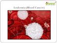Leukemia (Blood Cancer) PowerPoint PPT Presentation