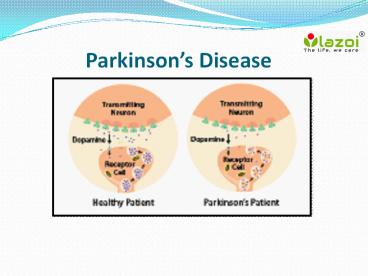 Parkinson’s Disease : overview, symptoms, causes, treatment and diagnosis