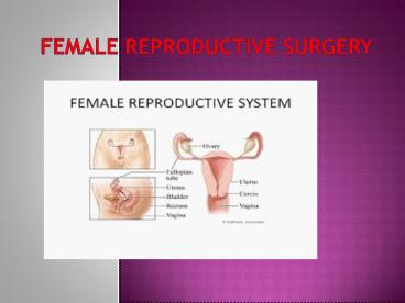 Female Reproductive Surgery 17july 17