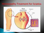Homeopathy Treatment For Sciatica 17july2017