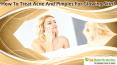 How To Treat Acne And Pimples For Glowing Skin? PowerPoint PPT Presentation