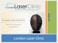 Hair Transplant PowerPoint PPT Presentation