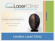 Hair Transplant