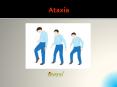 Ataxia: Types, Causes, Symptoms, Diagnosis and Treatments PowerPoint PPT Presentation