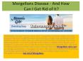What is Morgellons Disease - And How Can I Get Rid of It? PowerPoint PPT Presentation